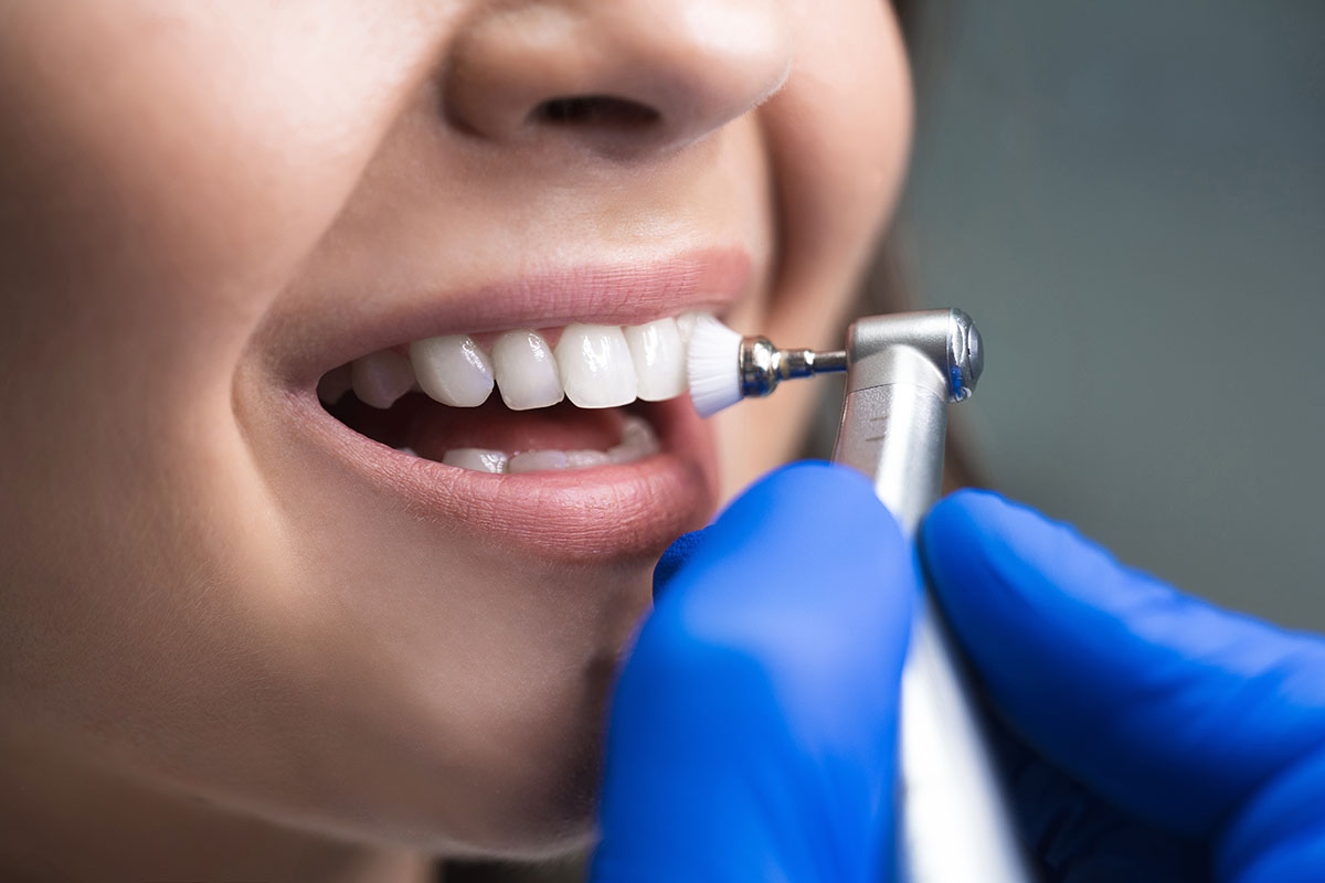 dental cleaning white dentistry Nogales